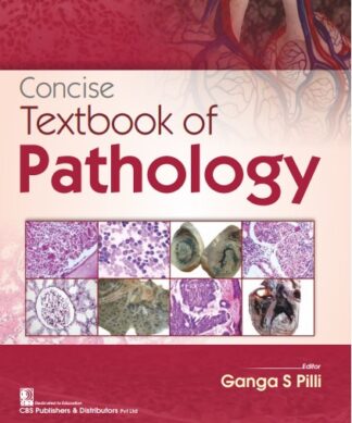 CONCISE TEXTBOOK OF PATHOLOGY
