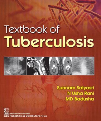 Textbook of Tuberculosis