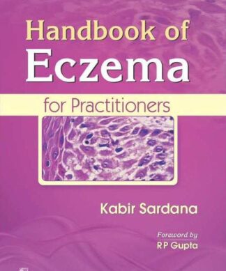 Handbook Of Eczema For Practitioners