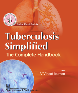 Tuberculosis Simplified The complete Handbook