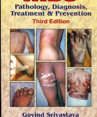 Aids Pathology, Diagnosis, Treatment & Prevention