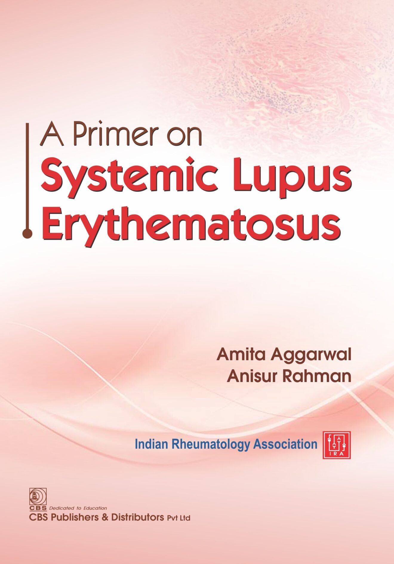 Sle Rash Textbook A Primer on Systemic Lupus Erythematosus - CABH - Caitanya Book House