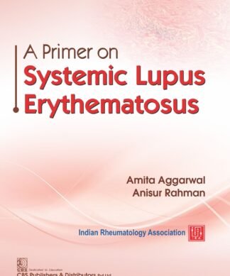 A Primer on Systemic Lupus Erythematosus